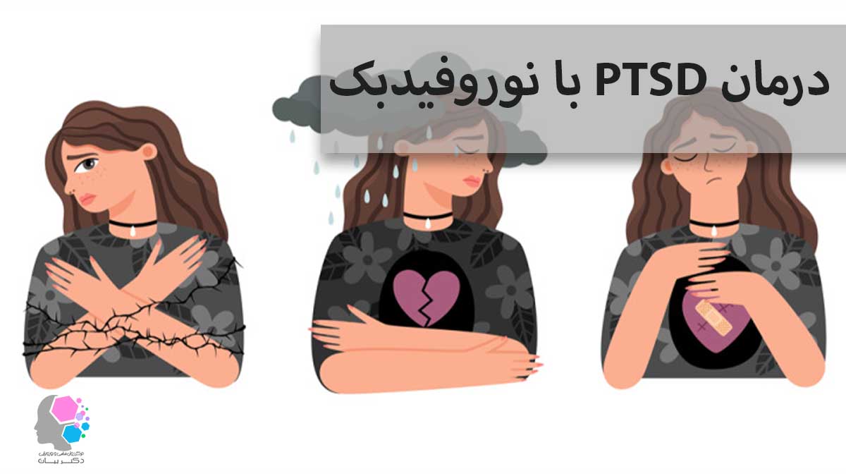 درمان PTSD با نوروفیدبک