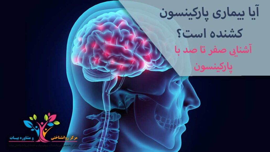 بیماری پارکینسون