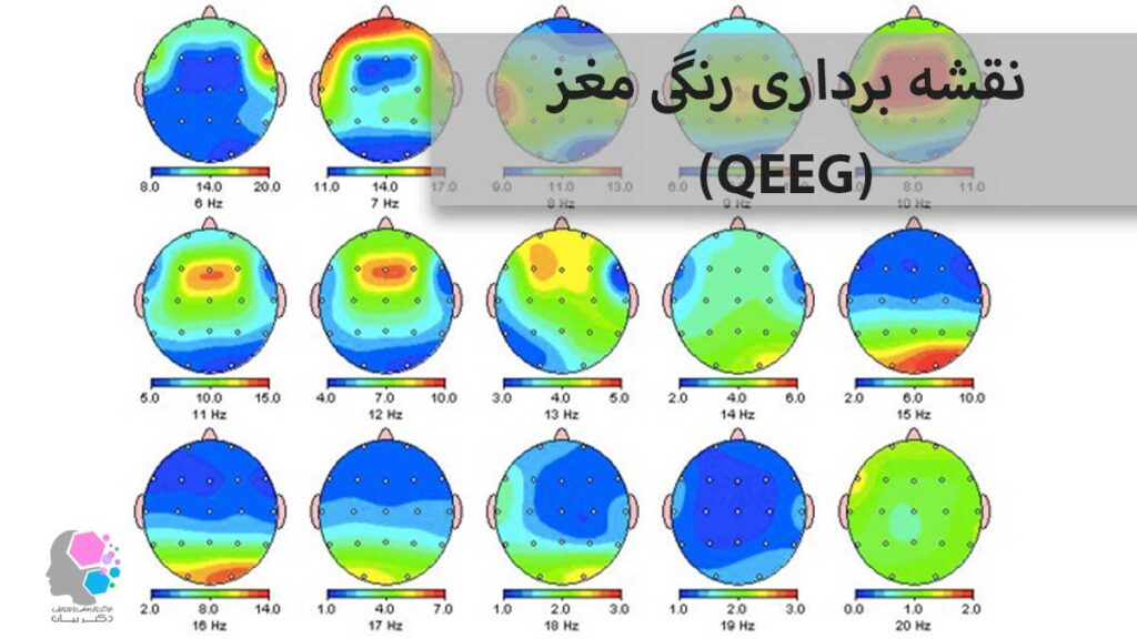 نقسه برداری رنگی مغز